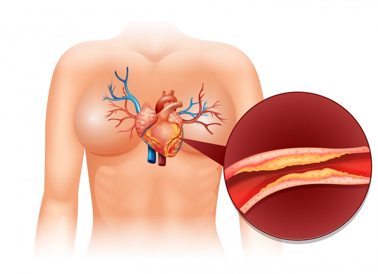 Emerging Therapies And Research Advances In Non-Vascular Disorders