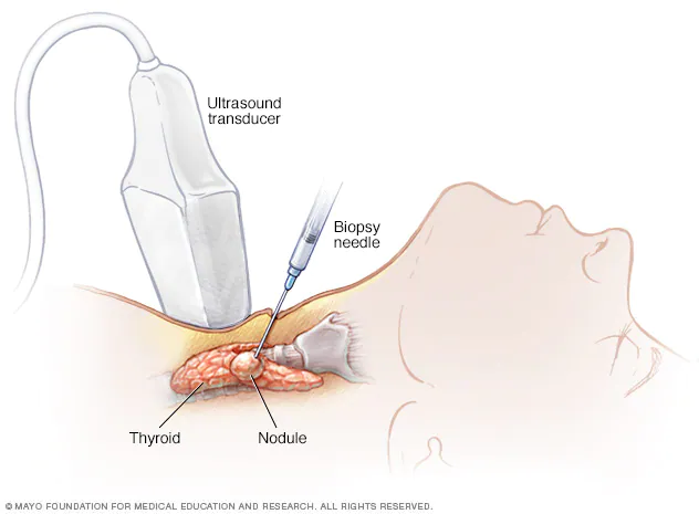 Understanding The Biopsy Process: What You Need To Know