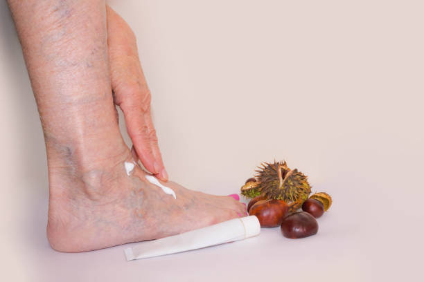 Diabetic Foot