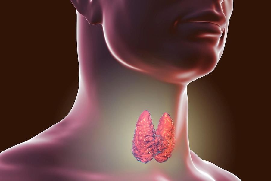 Thyroid Nodule