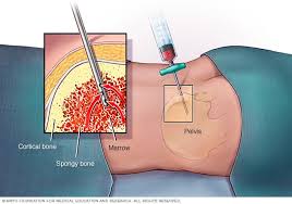 Best Biopsy Treatment in Noida