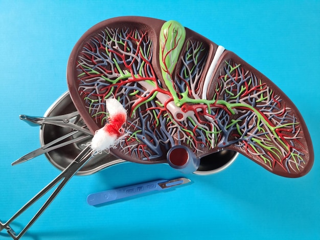 Best Varicocele Embolization in Sector 79