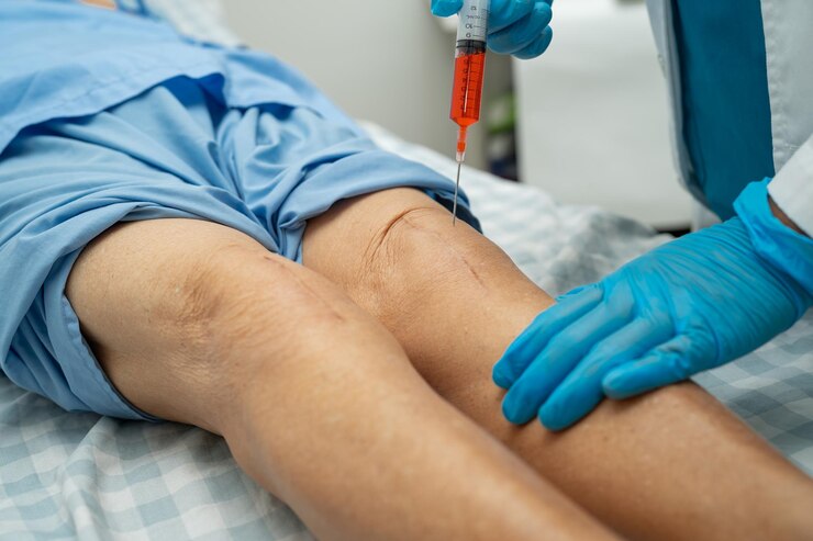 Best Varicose Veins Treatment in Sector 79