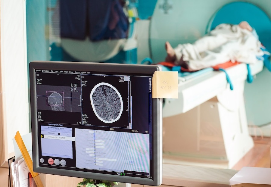 Best Neurointervention doctor in Sector 79, Noida