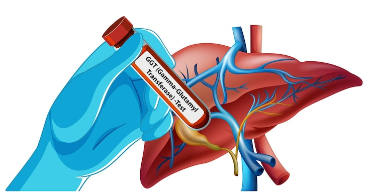 Best AVM Embolization Treatment in Sector 71