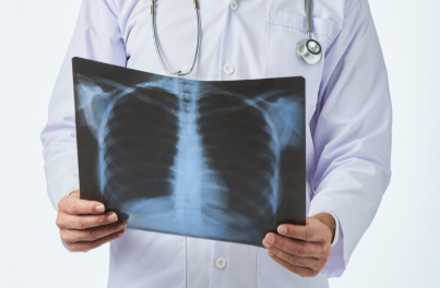 Best Radiologist doctor in Sector 71