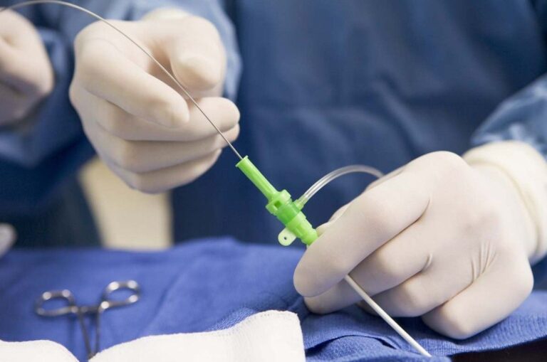 Best Endovascular Surgeon Doctor in Noida