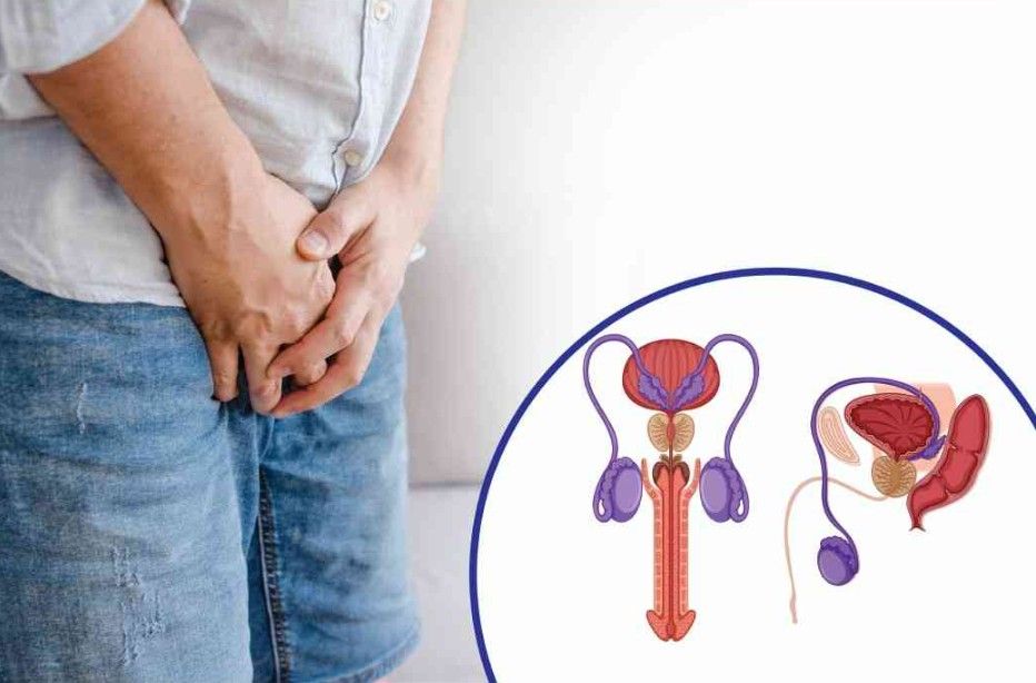 Best Varicocele Embolization Doctor in Noida