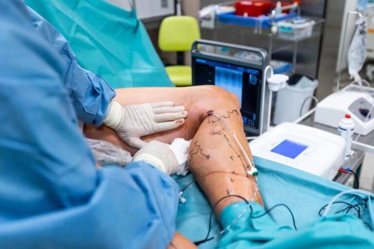 Best Endovascular Surgeon Doctor in Noida