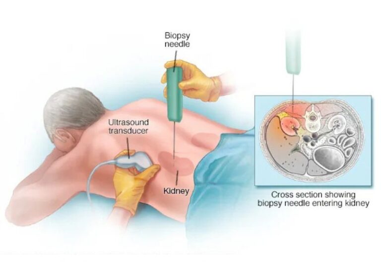 Best Biopsy Specialist in Noida